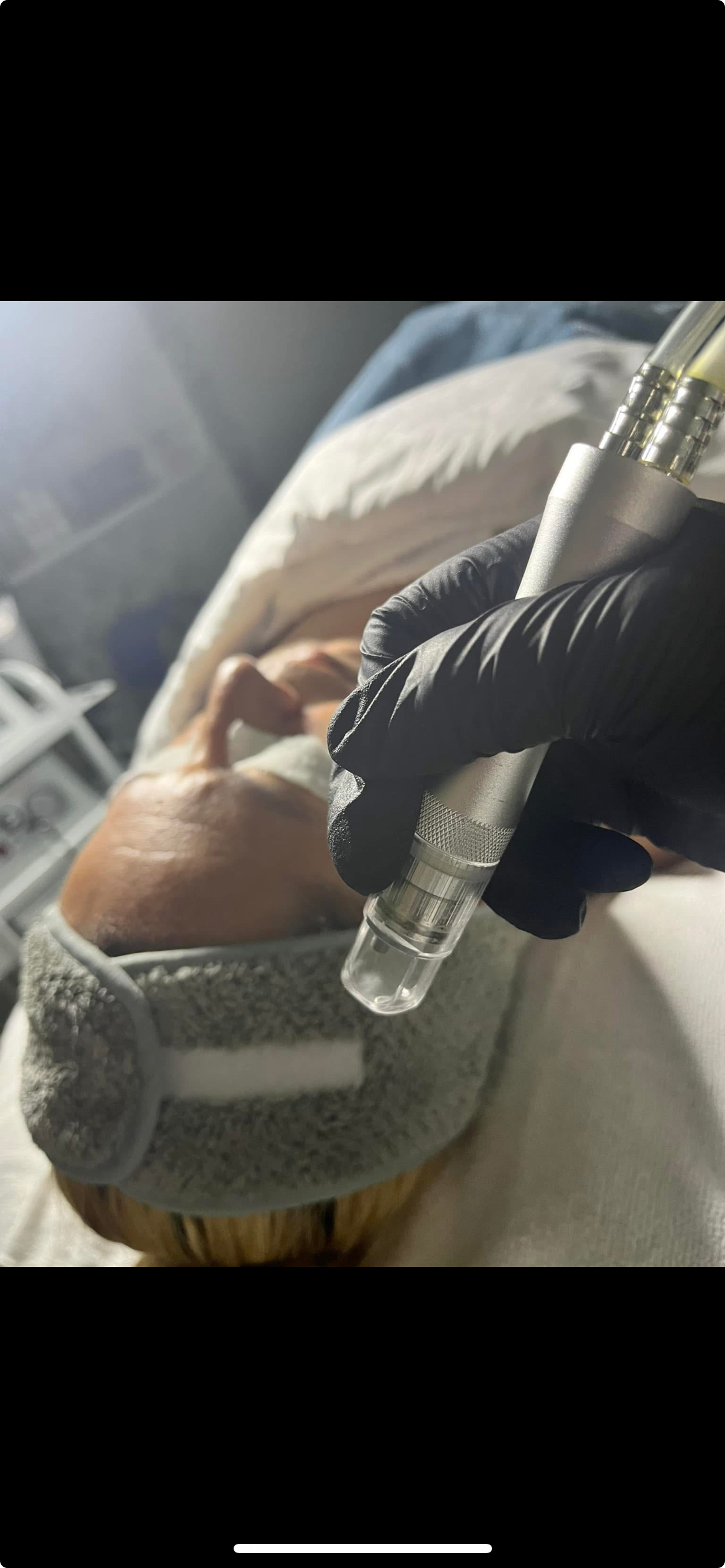 Crystal Microdermabrasion Facial at Baredayspa in Hickory, NC