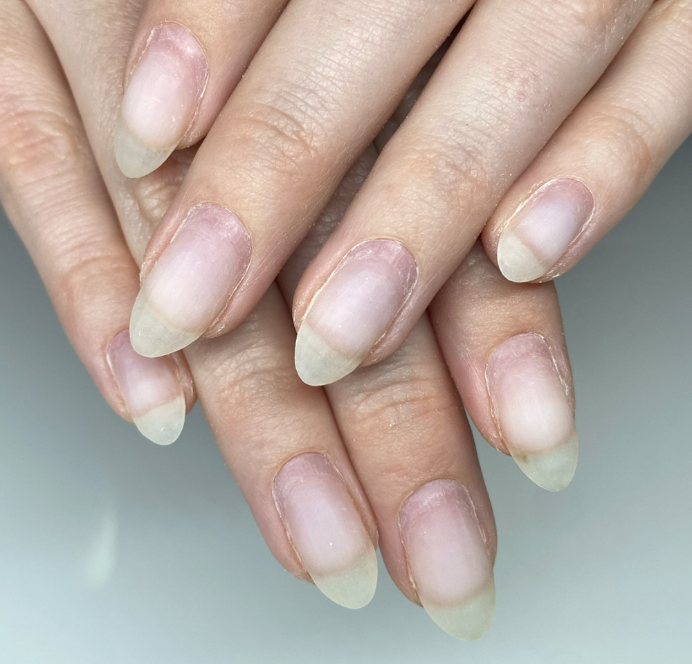 Gel Removal