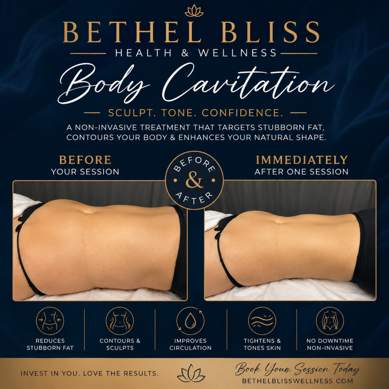 Body Cavitation at Bethel Bliss Health & Wellness in Washington, NC