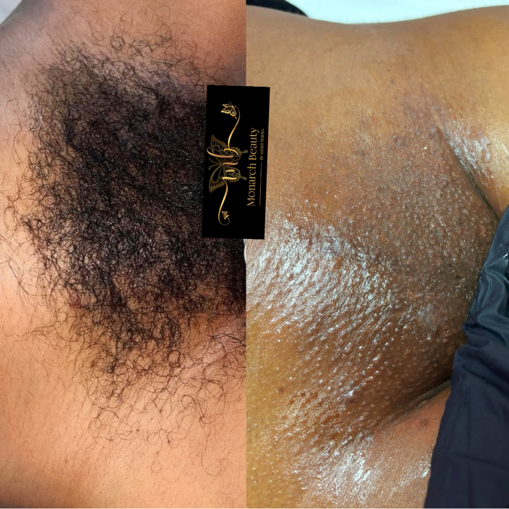 Brazilian Wax Class