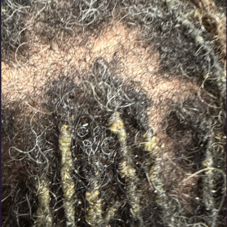 Scalp Detox Restoration Session at Nat-U-Reels Studios in Buford, GA