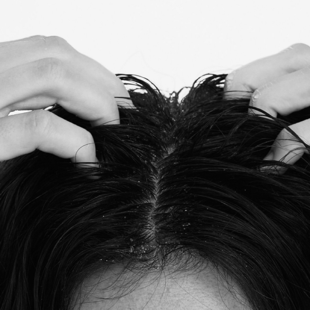 Sensitive Scalp Treatment at StyledByAutum in Mulberry, FL