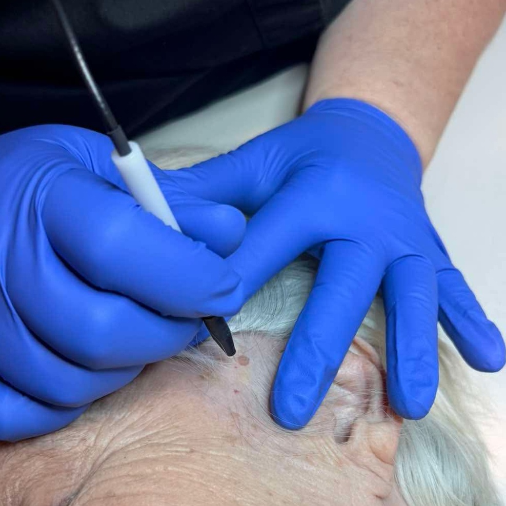 Skin Classic Treatment at Wonderfully Made Skin in Tempe, AZ