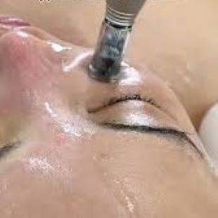 Serum Microneedling at Anew Med Spa in Baker City, OR