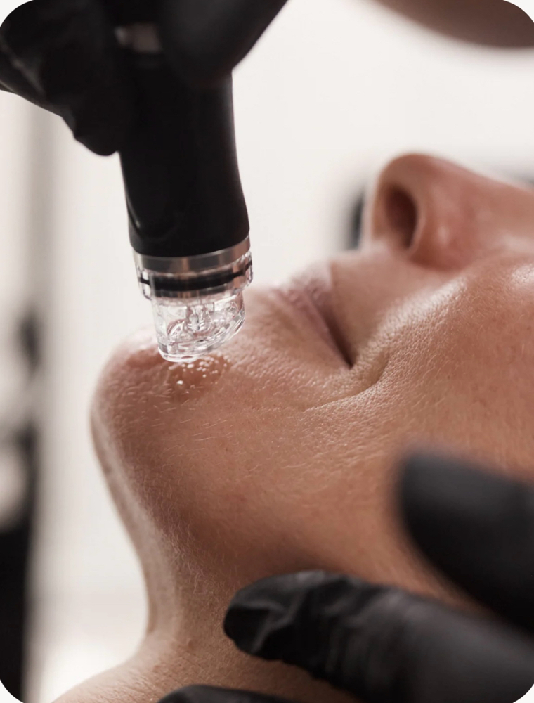 Deluxe Hydrafacial Membership at Elysian by My Shaping Spa in San Diego, CA