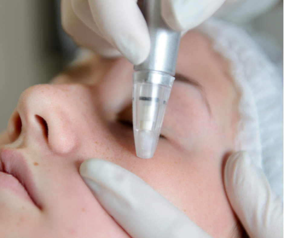 Microderm Facial