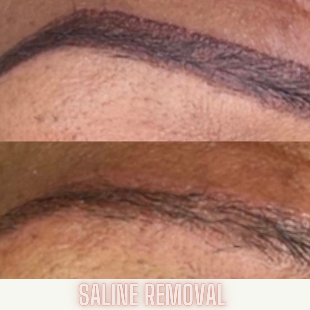 Saline Removal