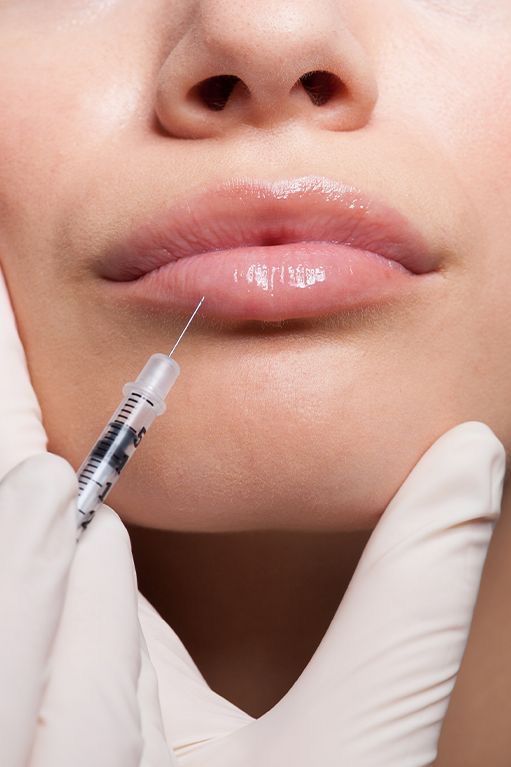 Lip Filler Dissolver