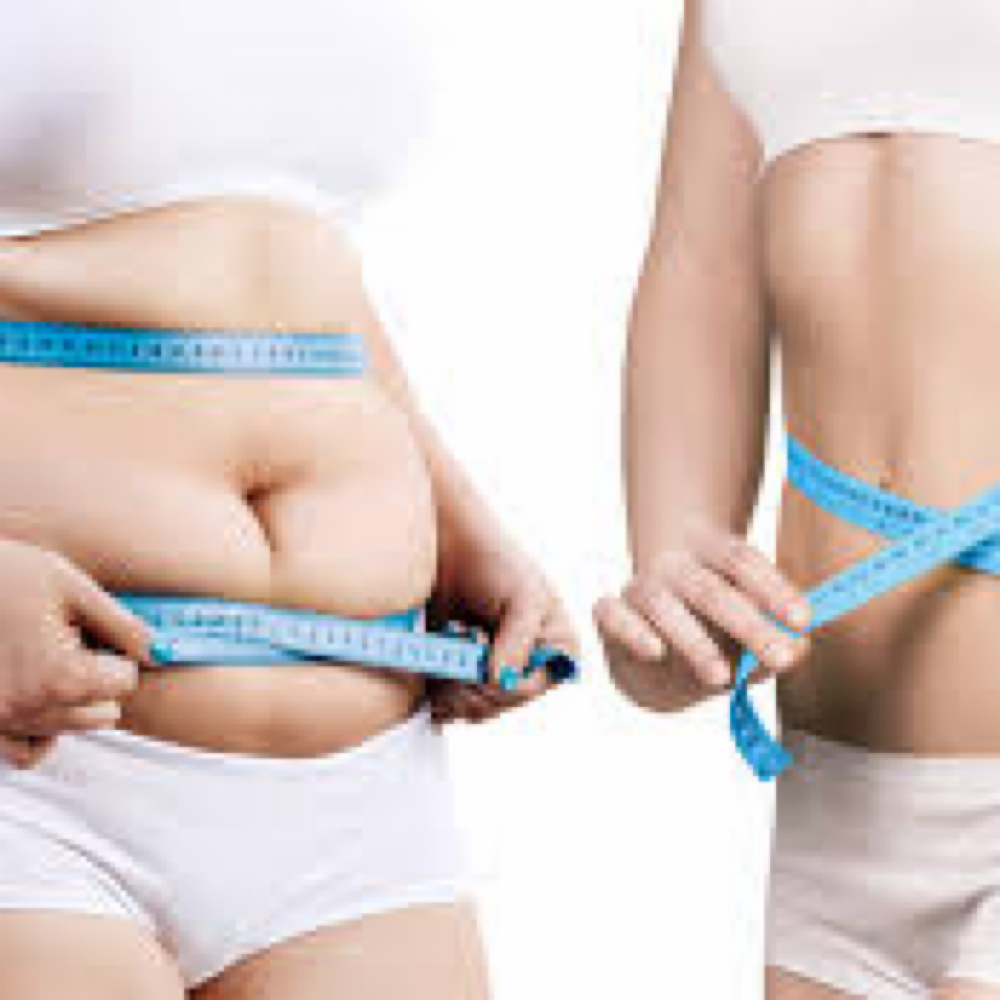 Weight Loss Consultation at Vitality IV & MedSpa in Wichita Falls, TX