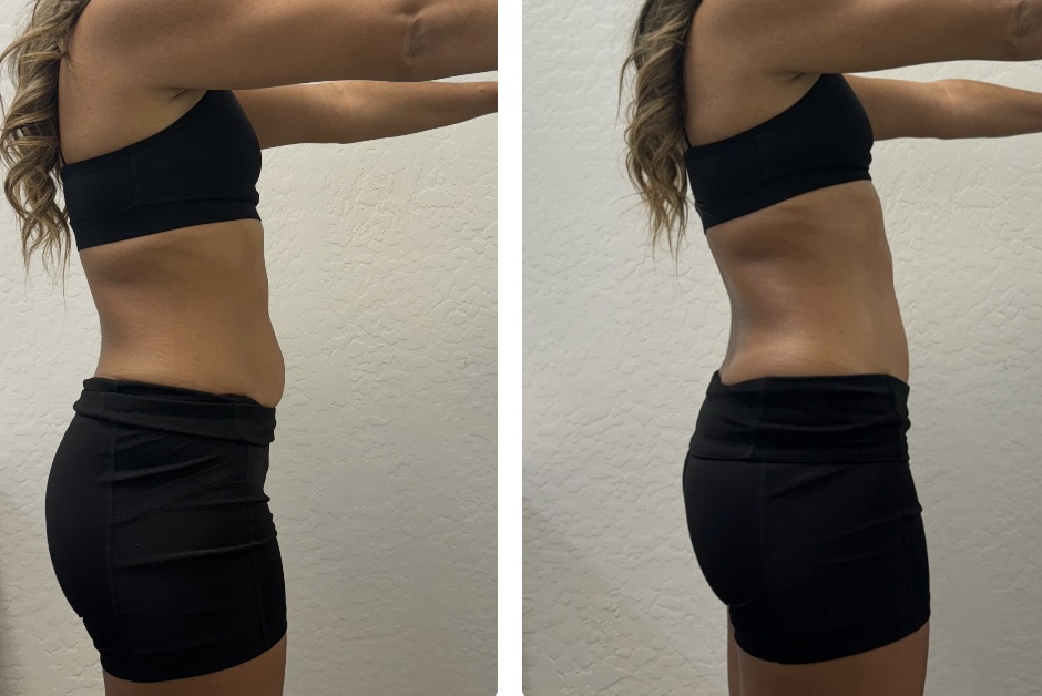 360 Sculpt & Snatch