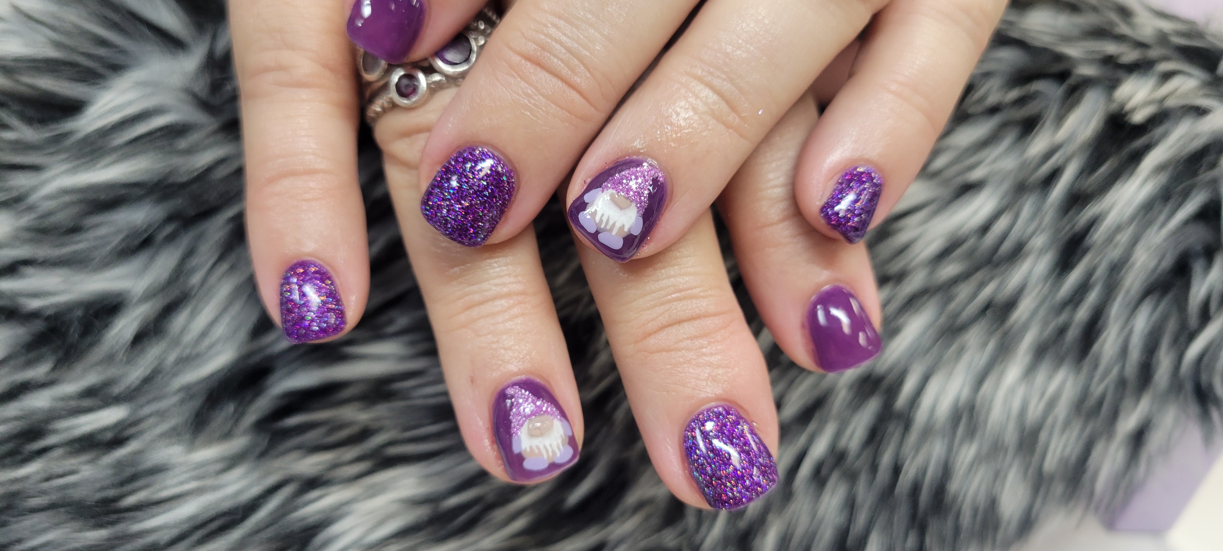 Acrylic Fill 3 week