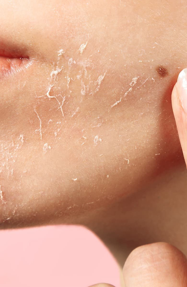 3 Session Chemical Peel W/ Kit