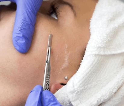 Dermaplane Facial