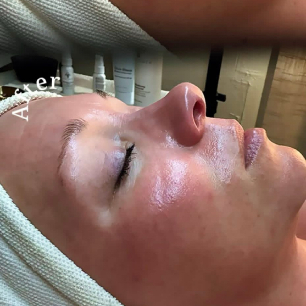 Anti-Aging Luxe Lift Facial at ZoGlo Esthetics in Goose Creek, SC