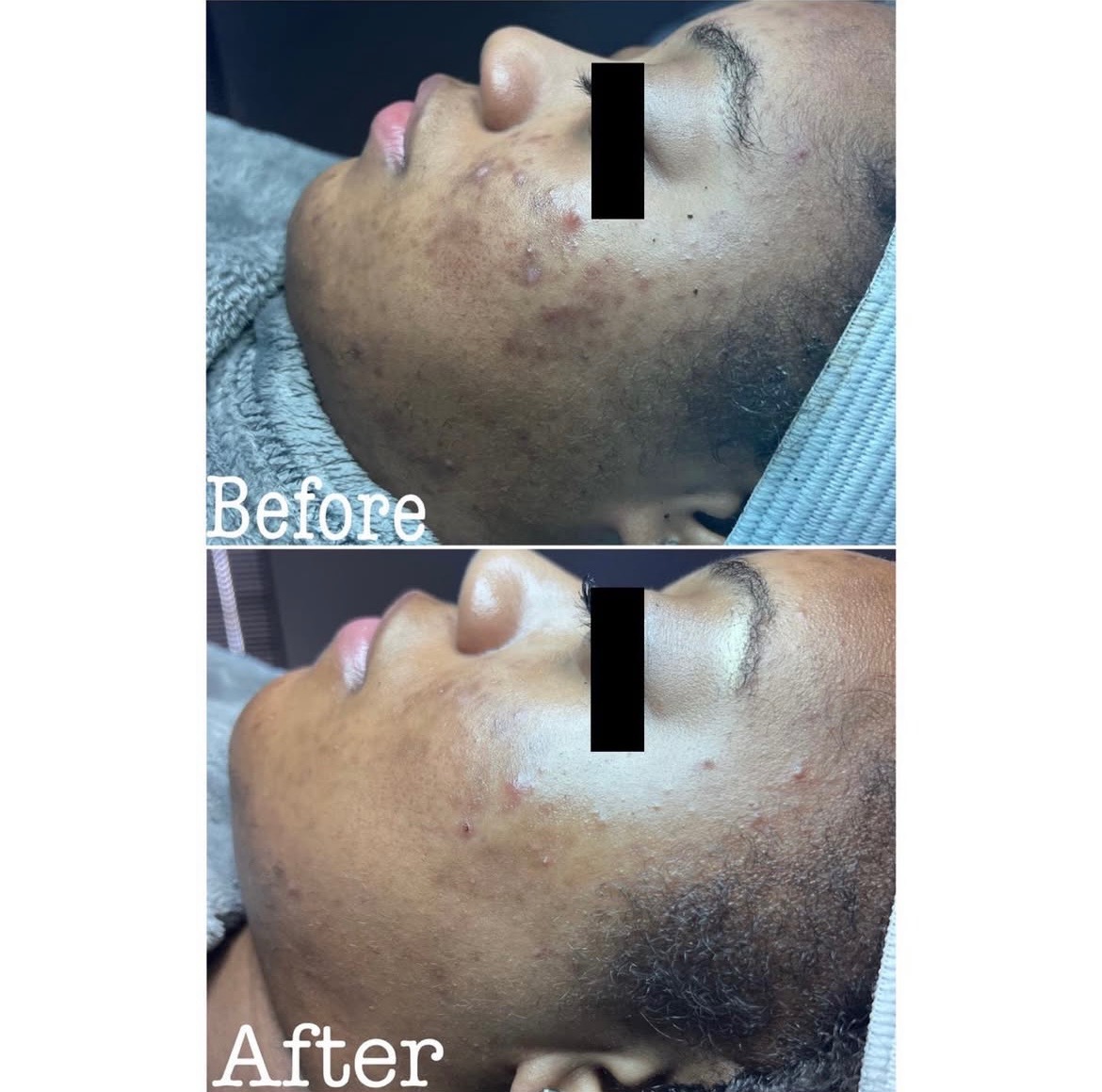 Brightening Facial