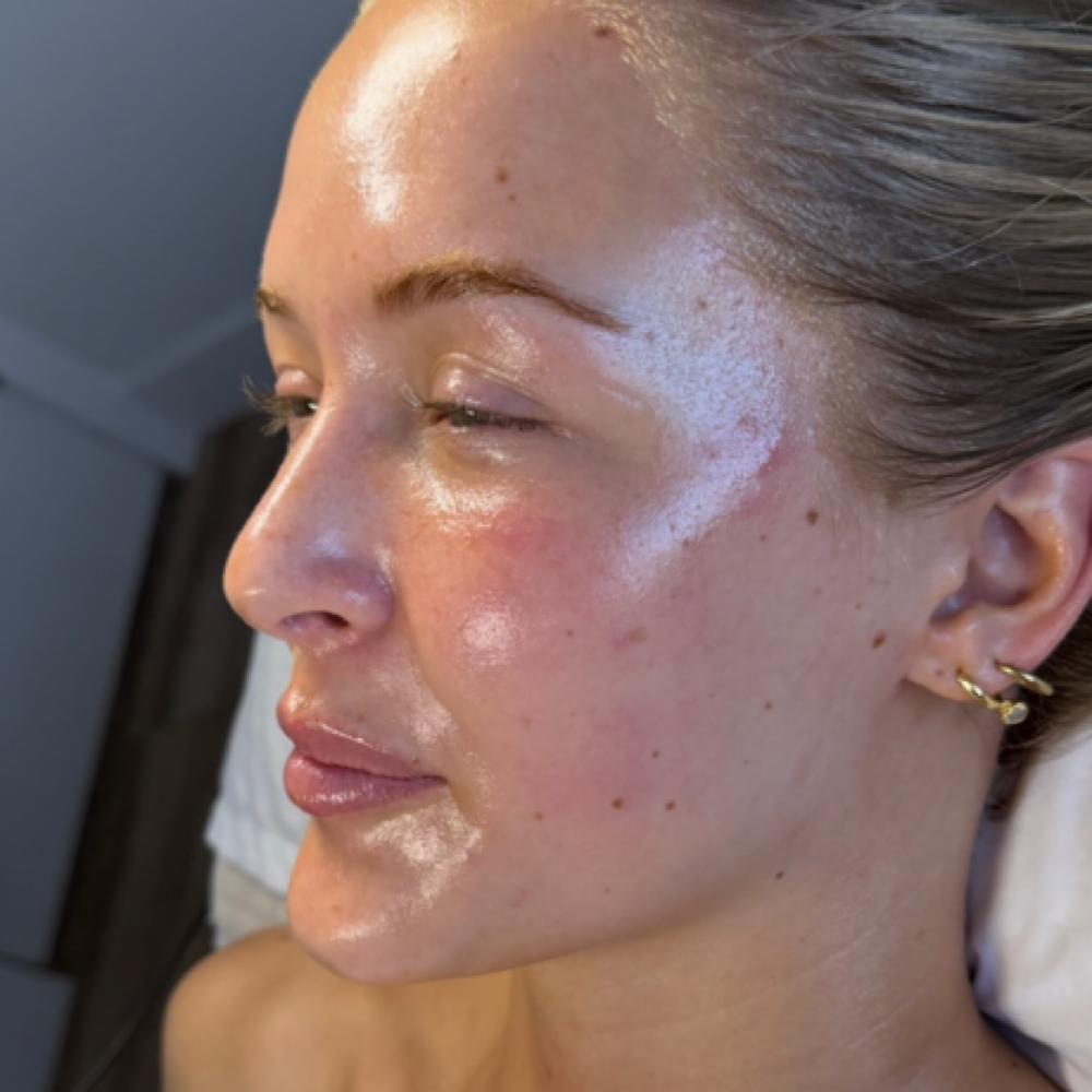 The Ultimate Facial at Mo Esthetics LLC in South Salt Lake, UT