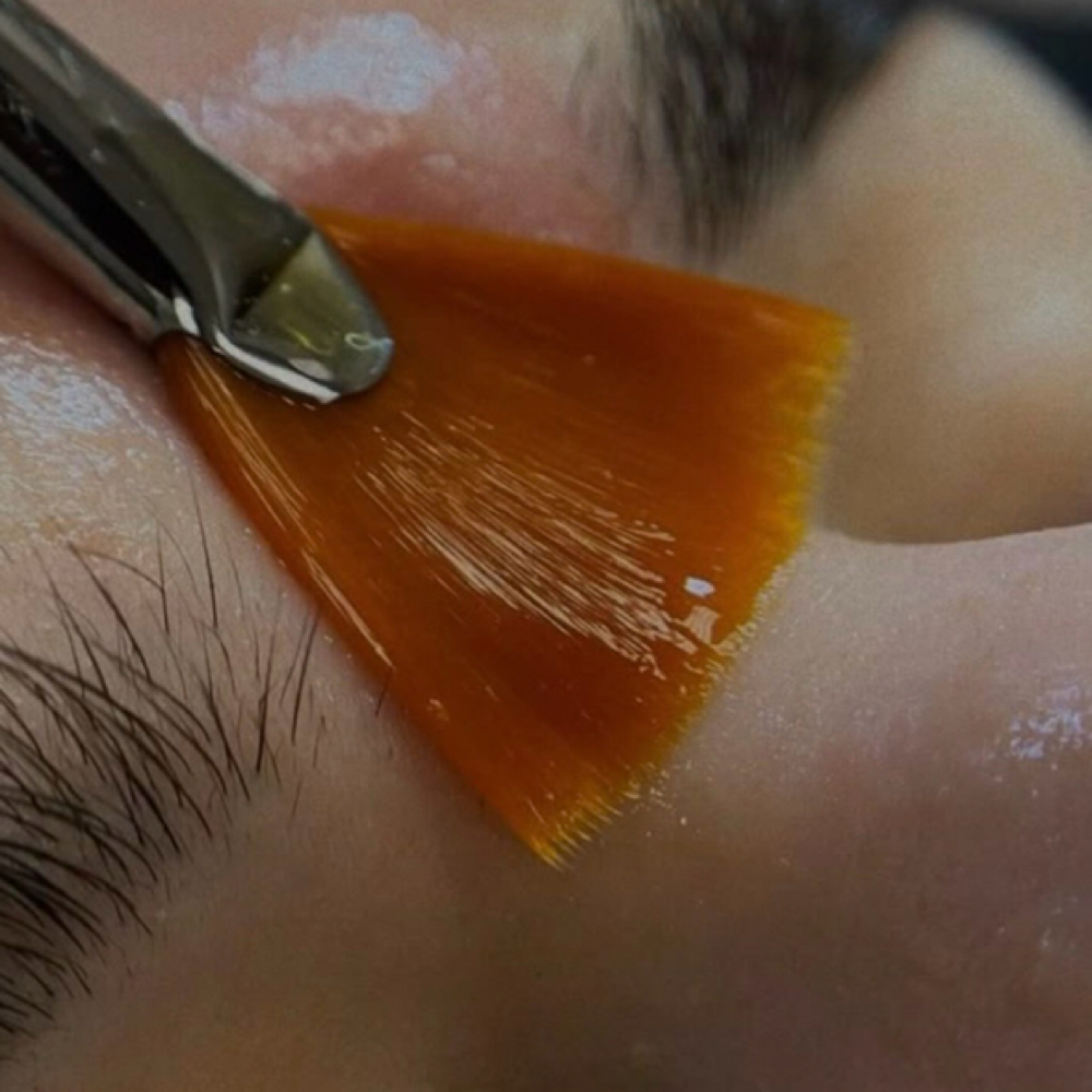 Pigment Lift Peel - Level 2 Peel at Esther Esthetics in Suwanee, GA