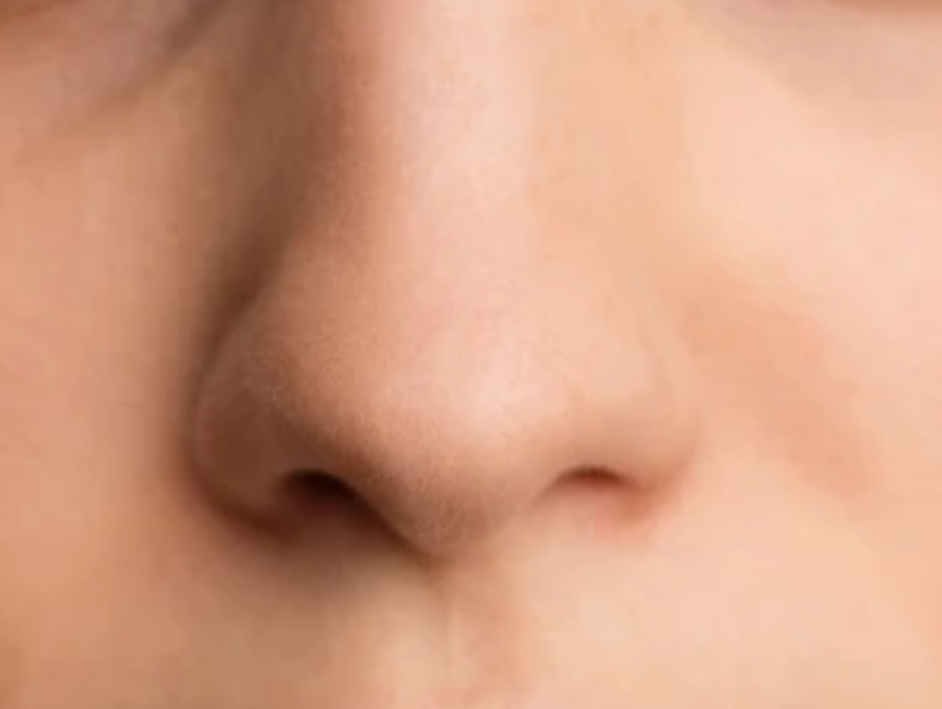 Nose