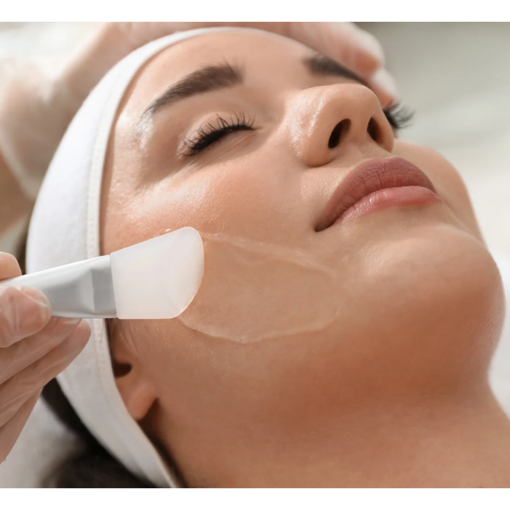 No Downtime Chemical Peel Facial