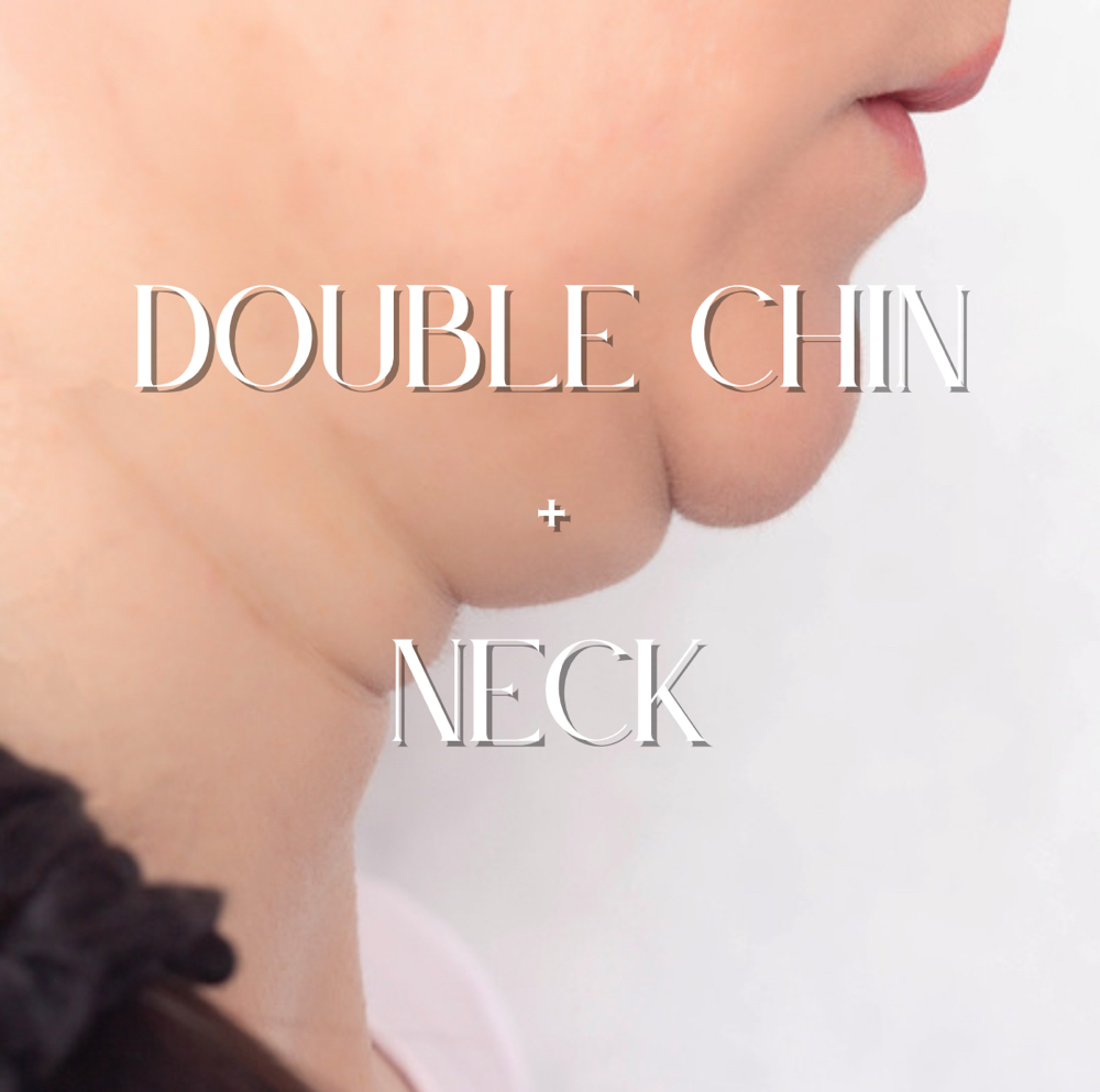 Double Chin + Neck