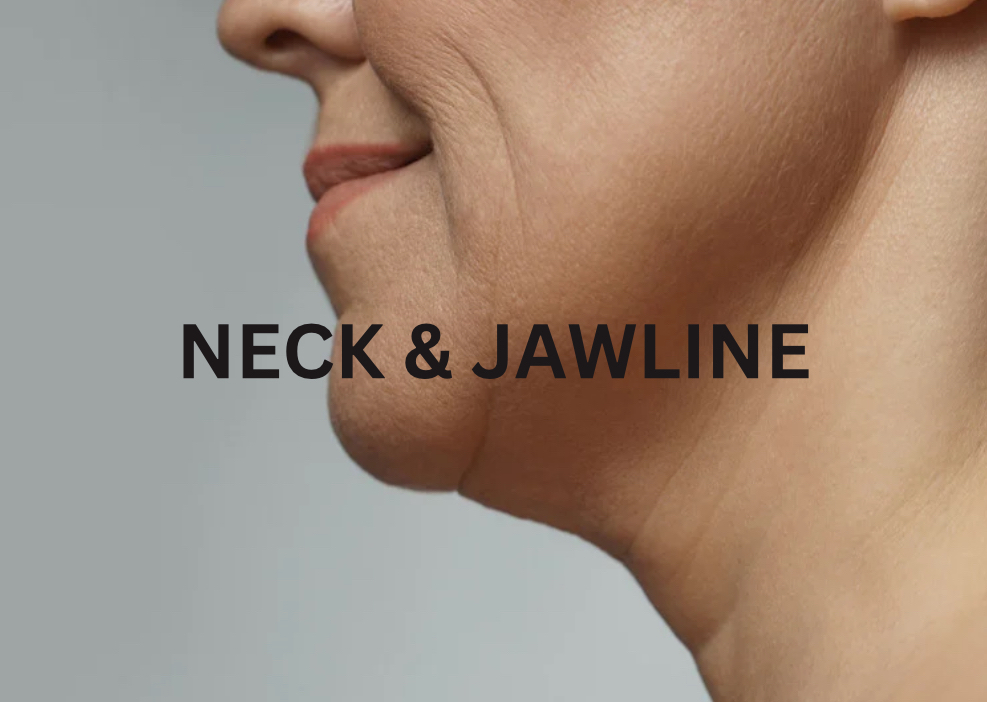 Neck/Double Chin