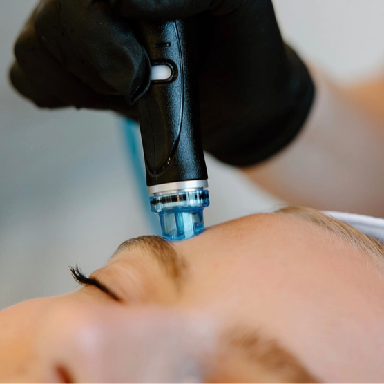 The Hydrafacial Experience at Skinology Aesthetics in West Caldwell, NJ