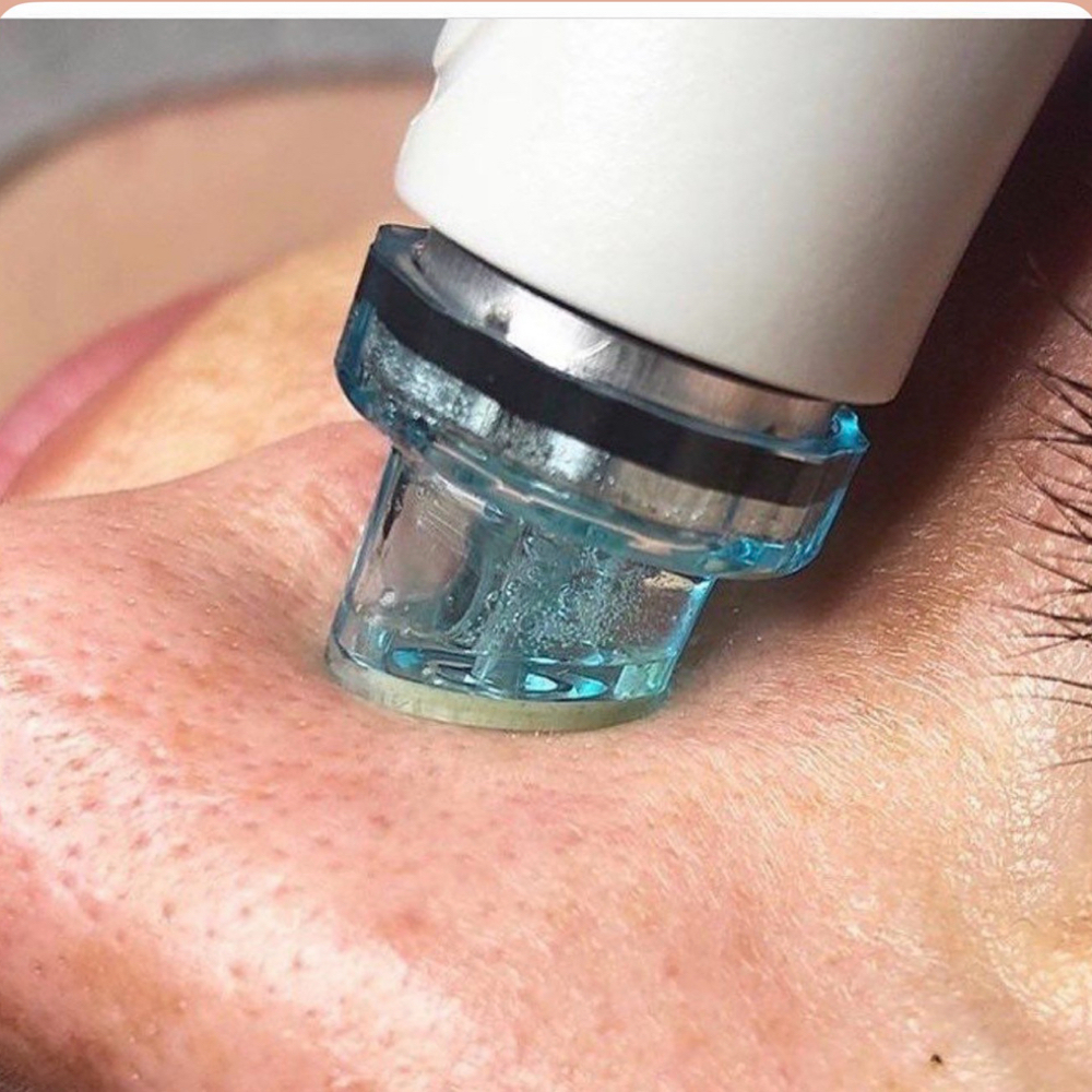Hydra Facial at SR Beauty Studios in Sacramento, CA