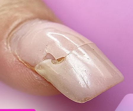 Nail Repair/Broken Nail