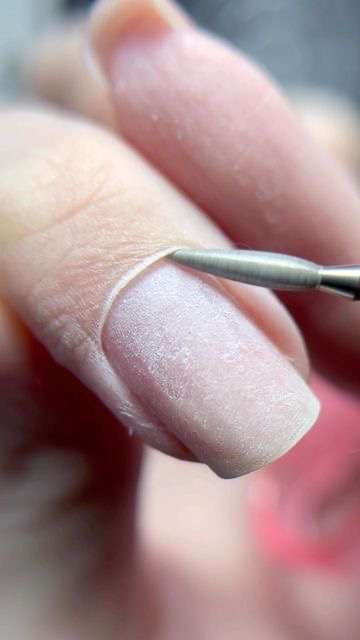Nail Replacement