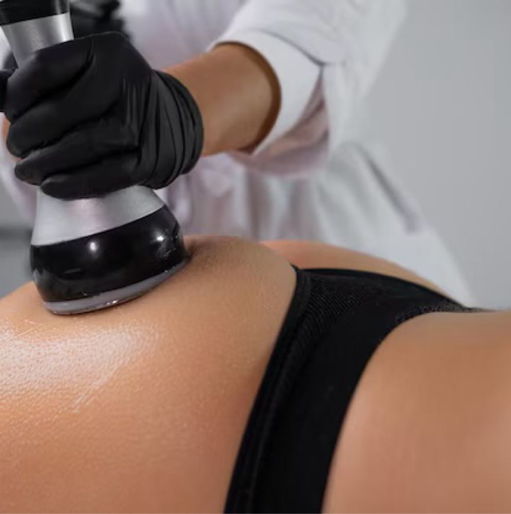 Non-Surgical Body Contouring