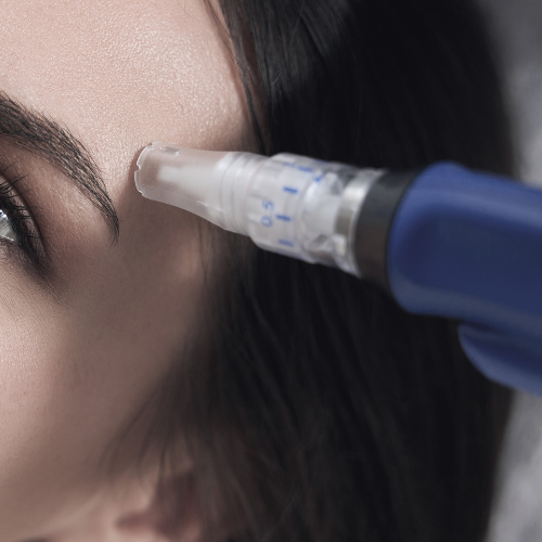 Collagen Surge | Microneedling