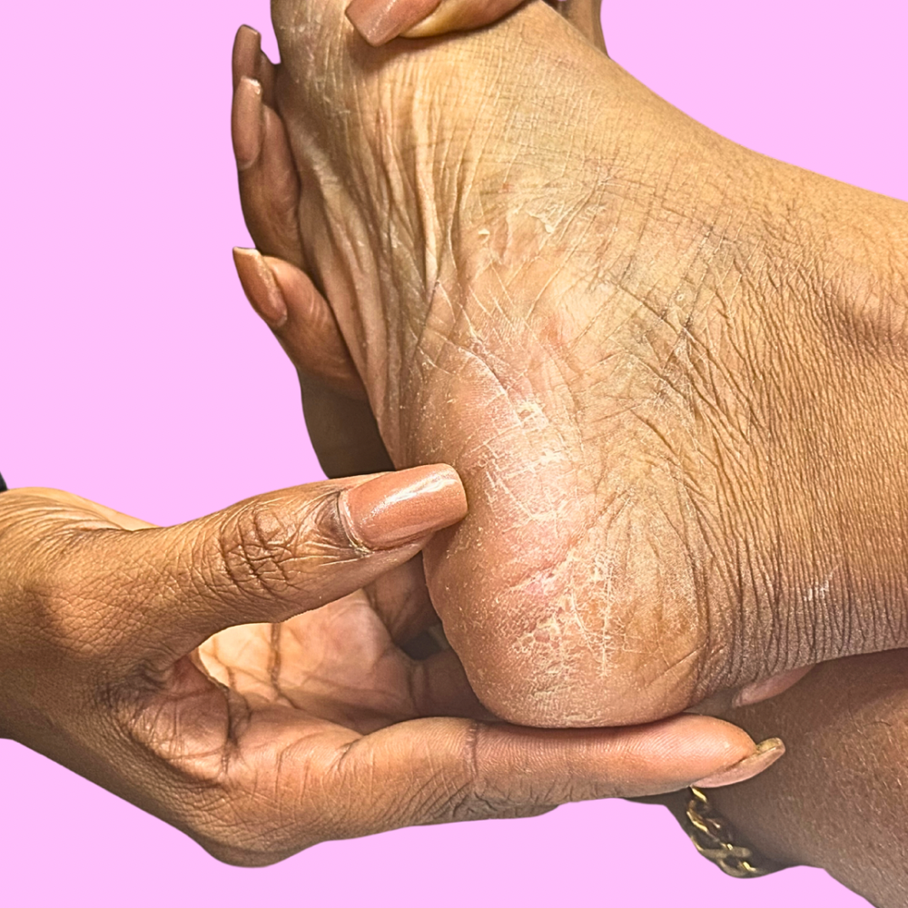 Medi Pedi + Sports Foot Care