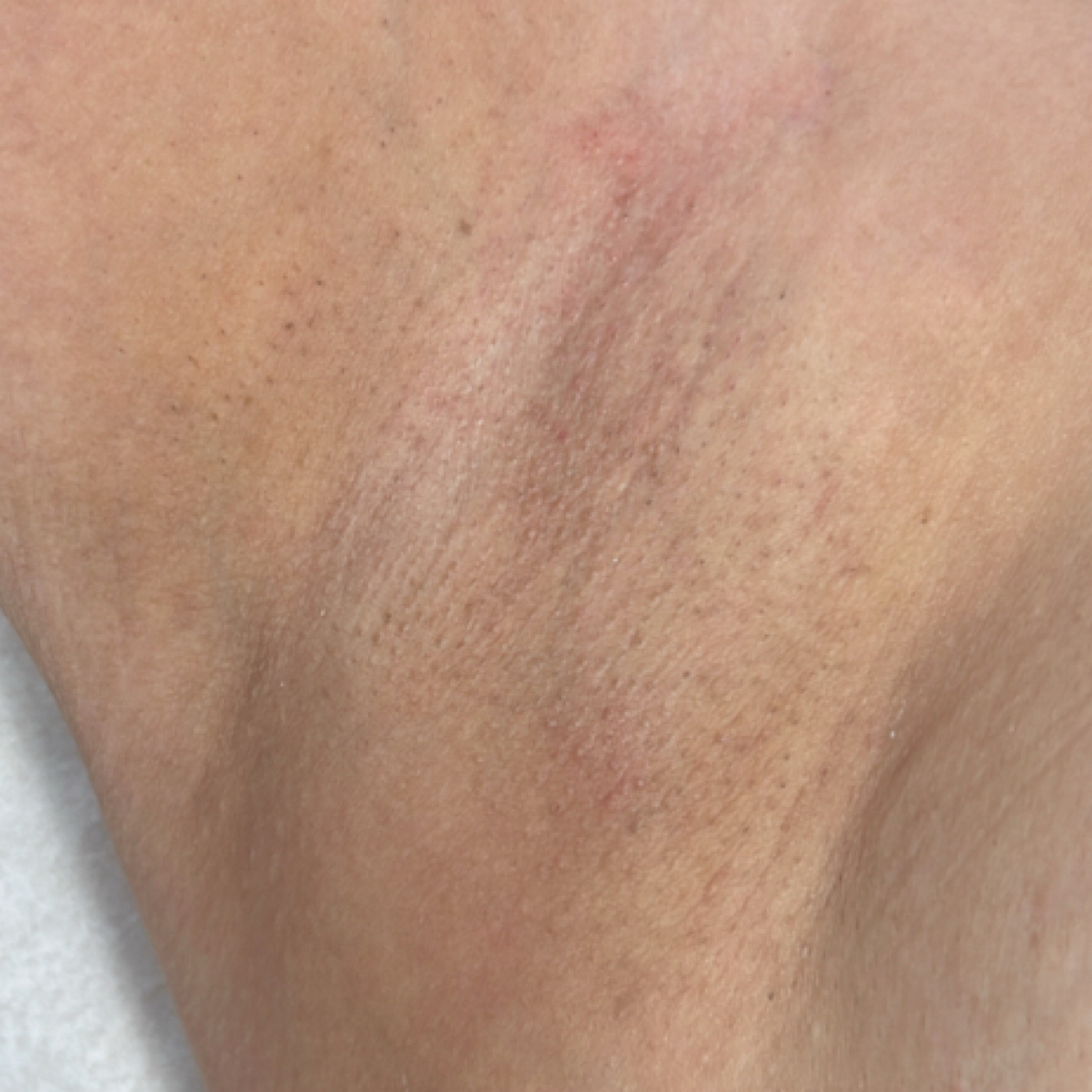 Underarms at Simply Waxed in Fontana, CA