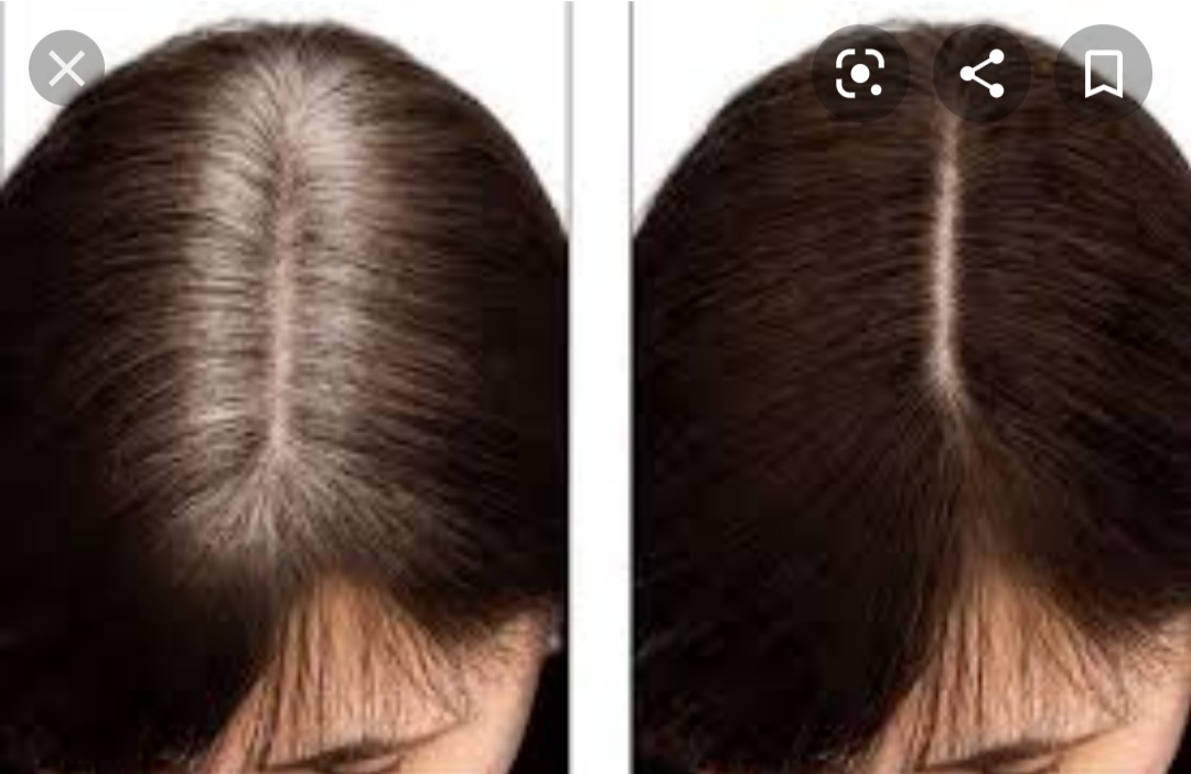 Root Retouch Color