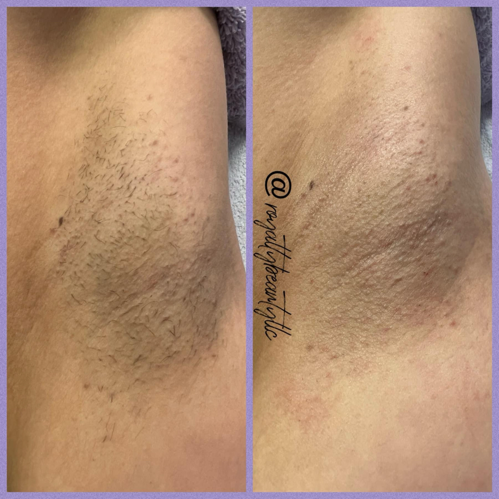 Underarm Wax at Melanin Beauty Bar in La Crosse, WI