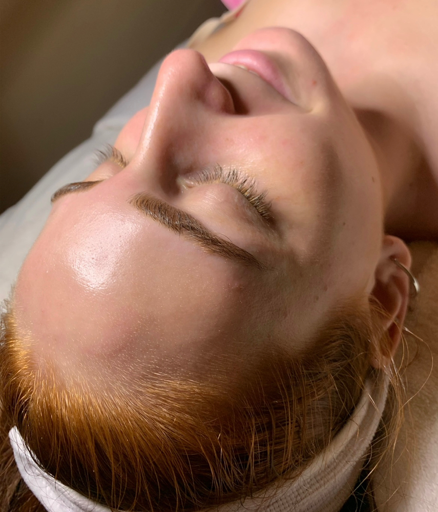 Hydra Facial