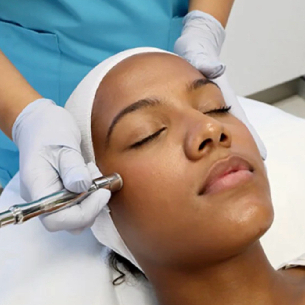 Microderm Rev Facial at Revitalize Health in Florence, SC