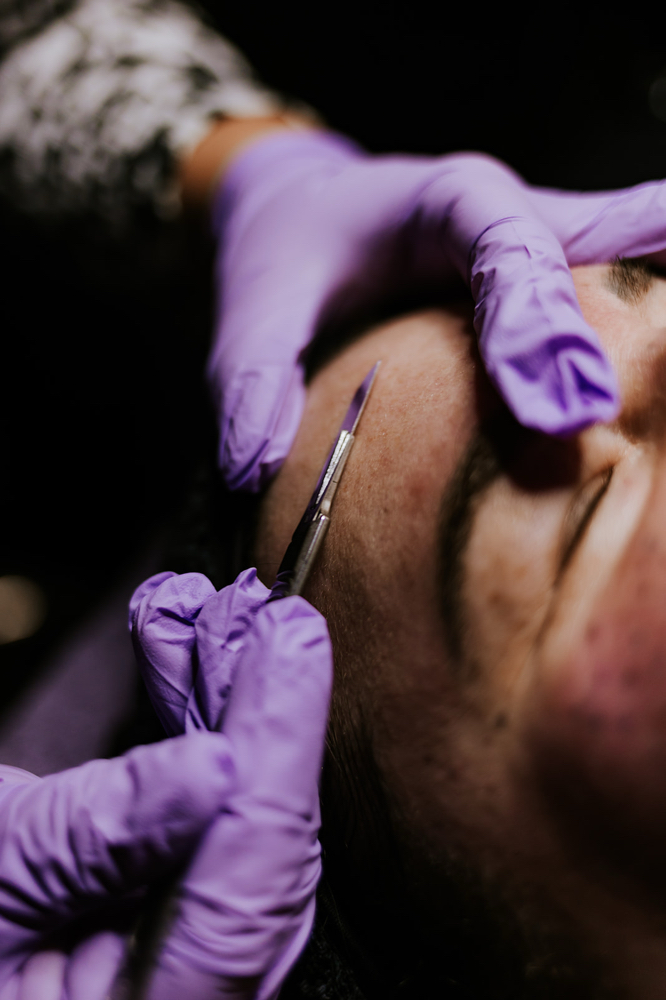 Dermaplane