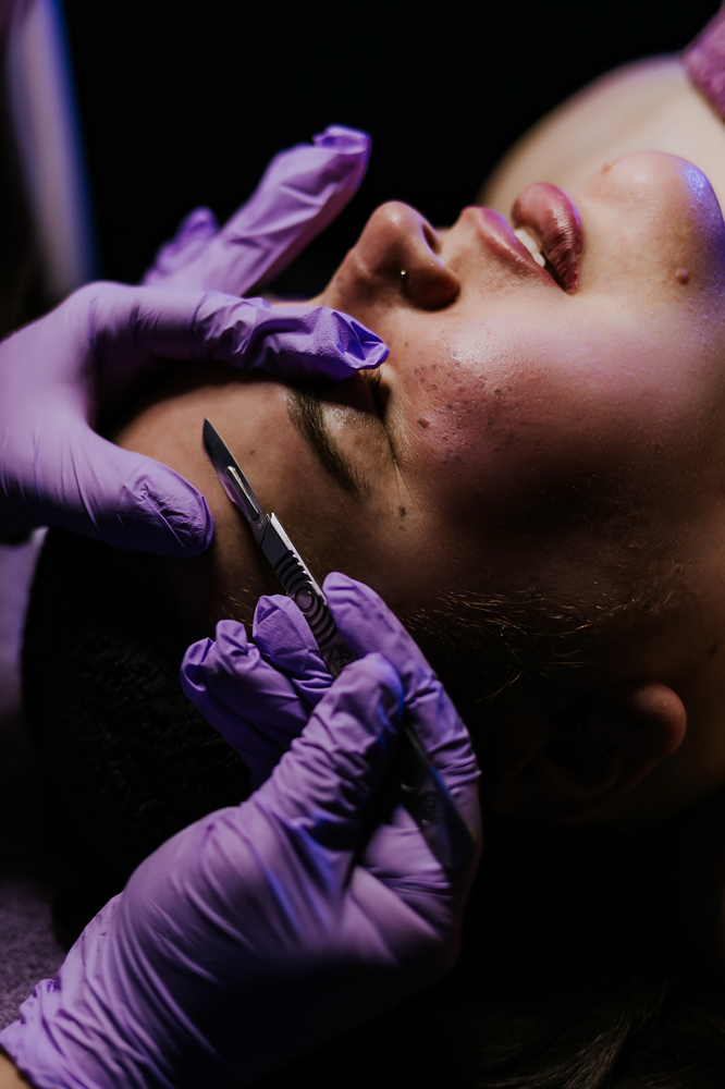 Dermaplane (Facial add-on only)