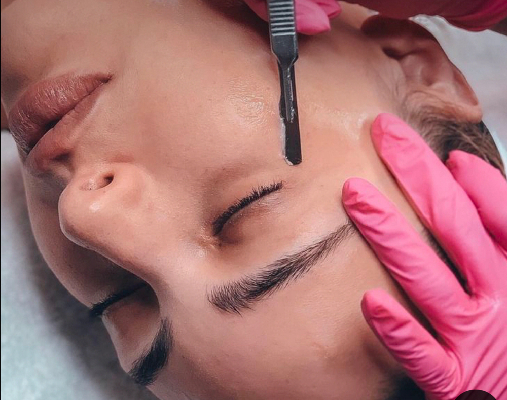 Dermaplaning