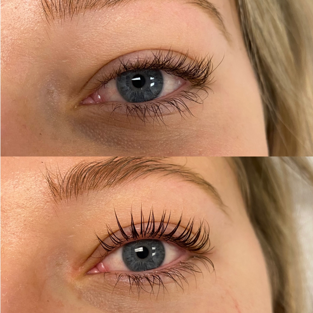 Lash Lift