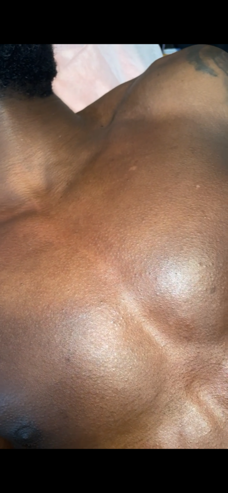 Chest