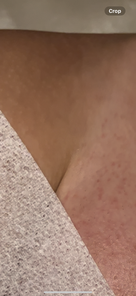 Full Bikini Wax (Bikini Line only) at GLAMMED BY NEESA in Grand Terrace, CA