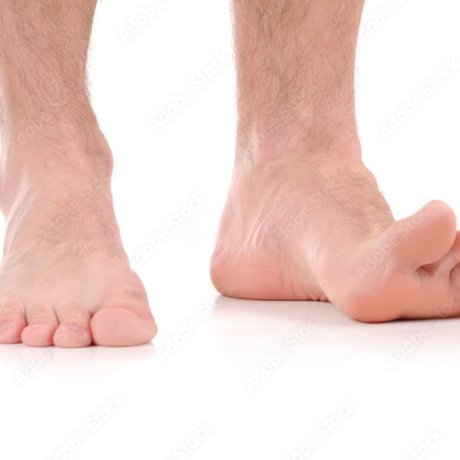 Feet+Toes at The Art of Brazilian Wax in Tampa, FL