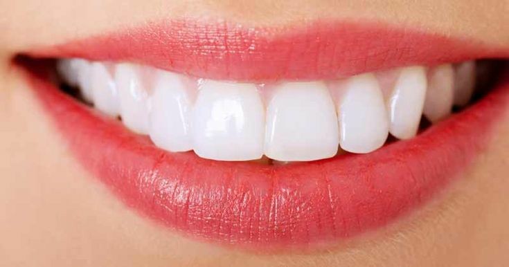 30 Minute Teeth Whitening