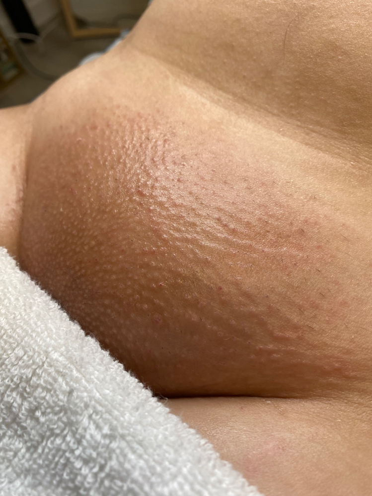 Brazilian Wax