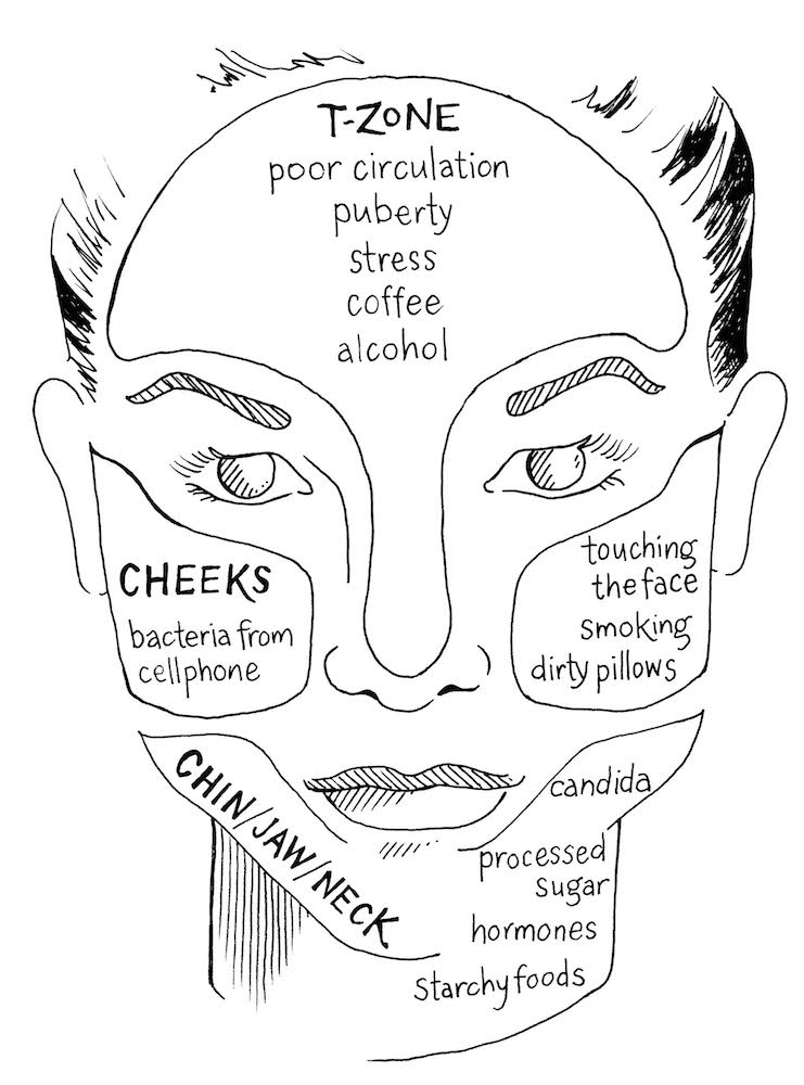 Acne Facial