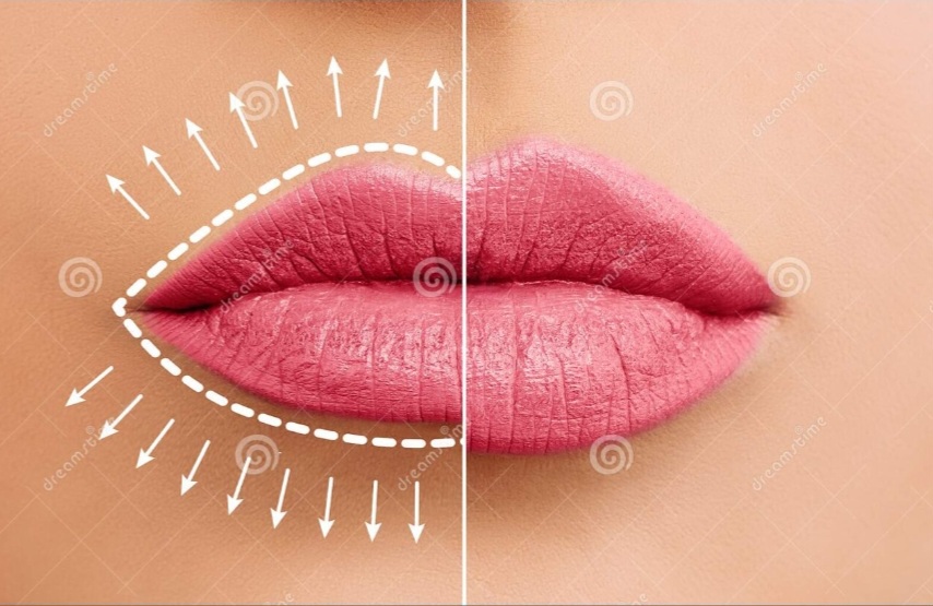 Lip Flip