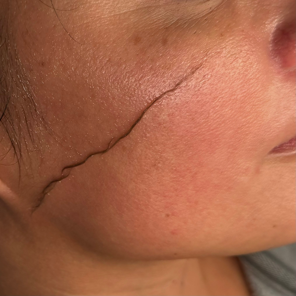 Facial & Dermaplane