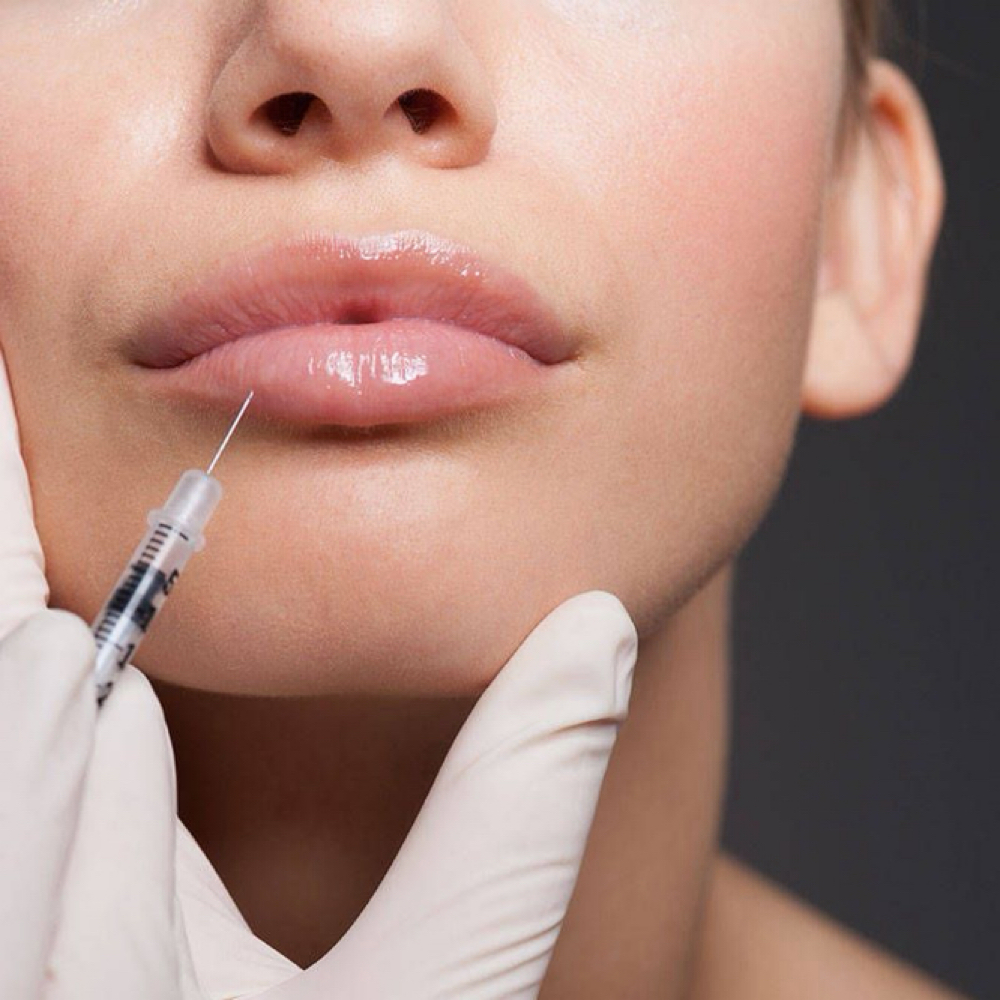 Lip Fillers/Relleno De Labios 0.5mL at Lumé Aesthetics in Pharr, TX